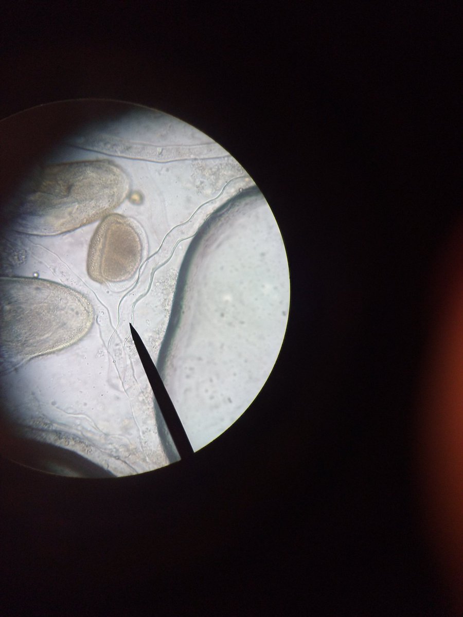 PaulineSSVT's tweet photo. Observation d'un tube pollinique au microscope #fleurdorian #poste2 https://t.co/49pzT74LtJ