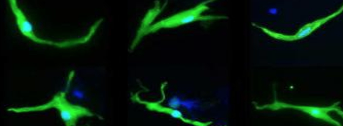 LIFEmagNews's tweet photo. News: Can stem cell technology be harnessed to generate biological pacemakers? #stemcell #medicine #future https://t.co/fKbL5JFI5B