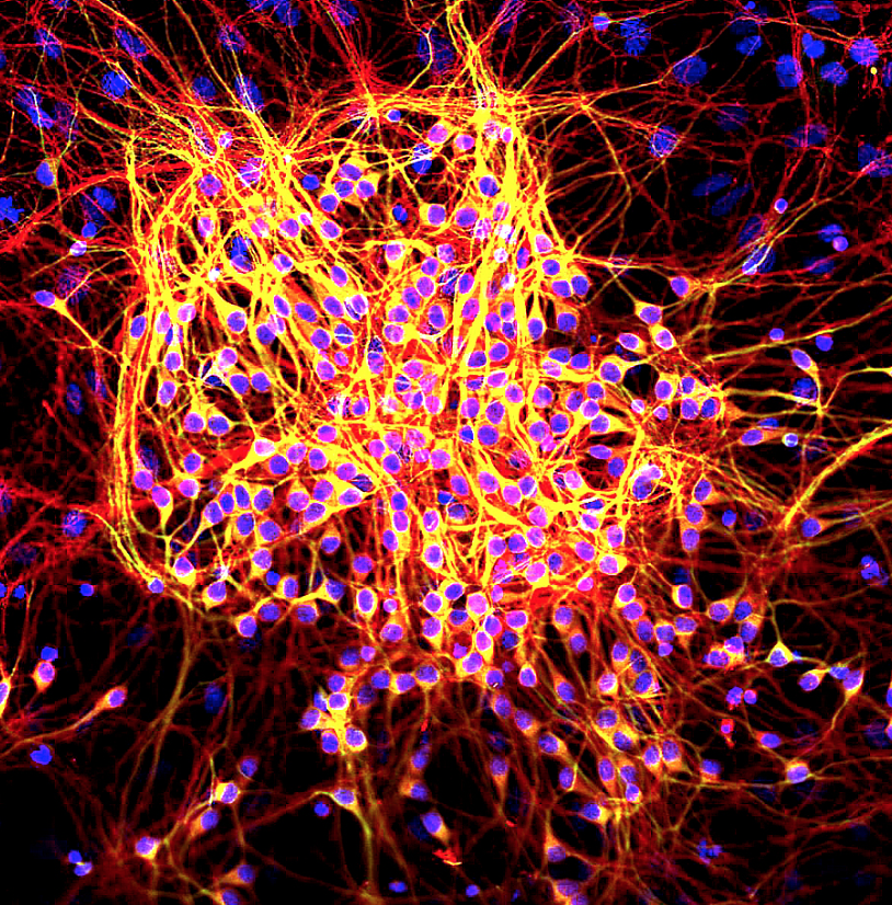LIFEmagNews's tweet photo. News: Infertile worms resist infection-induced neurodegeneration #neurons #aging https://t.co/ULsXElu85e https://t.co/Qnp7hAQ2R8