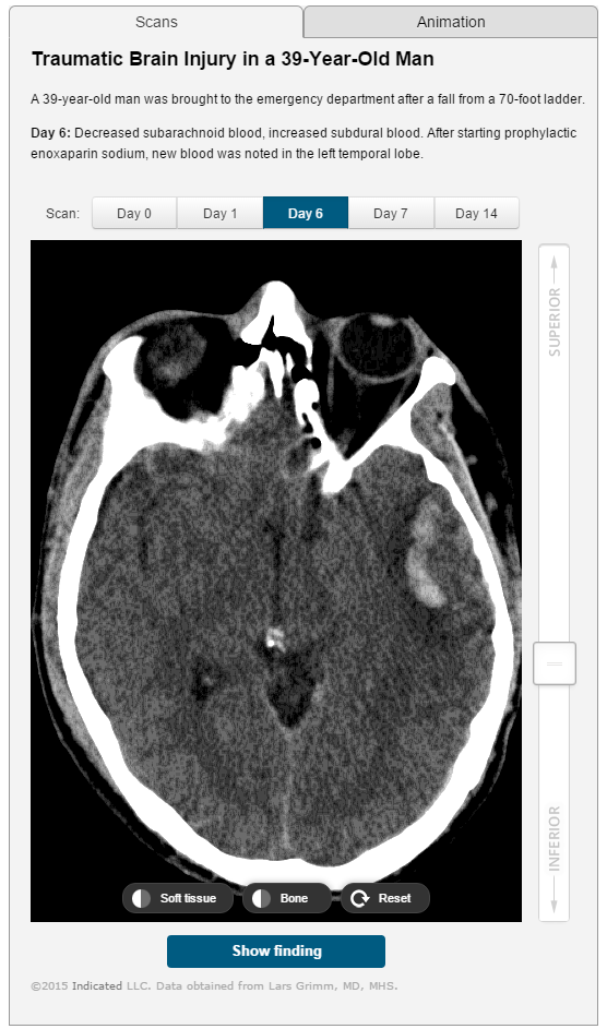indicated's tweet photo. Check out our latest radiology case with @Medscape: Traumatic Brain Injury. https://t.co/3jBw07D218 @MedscapeRads https://t.co/PHdIeAbvMK