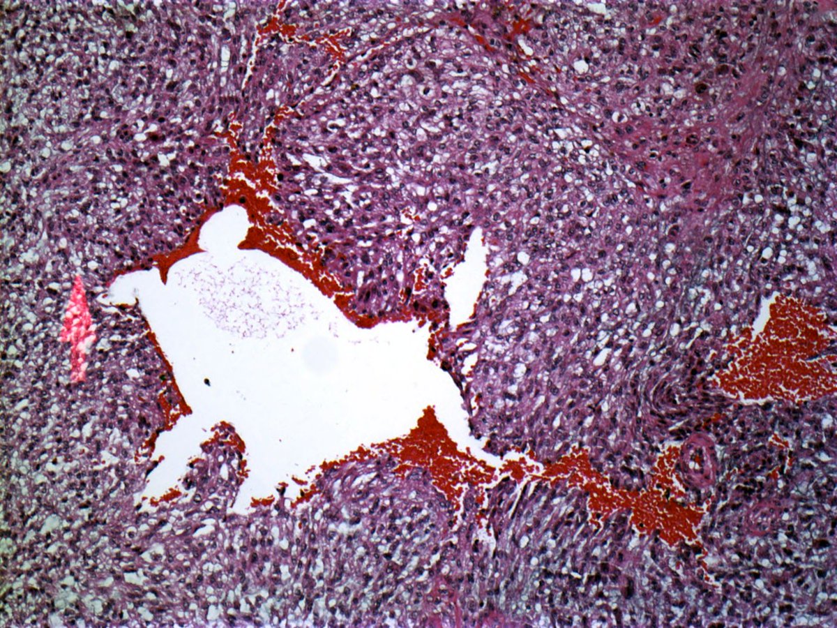 Dr_Jukic's tweet photo. Spanish bull in an AFX ... #dermatology #pathology #dempath #dermatopathology https://t.co/DyIXsJZY57
