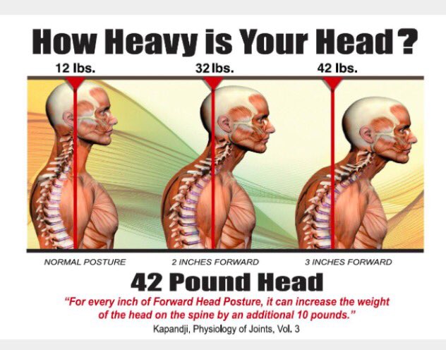 mbmassage8's tweet photo. #posturalproblems #neckstrain#pain #ctjpain #head #softtissuetherapy #Advancedsofttissuetherapy #mbmassage #massage https://t.co/qFlPC6bB4o