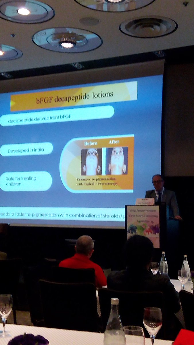 GlobalVitiligo's tweet photo. Prof Torello Lotti on Vitiligo Research -  What's new and what's true in 2015. @vrfoundation @vitsaf https://t.co/IMFXWQpCB5