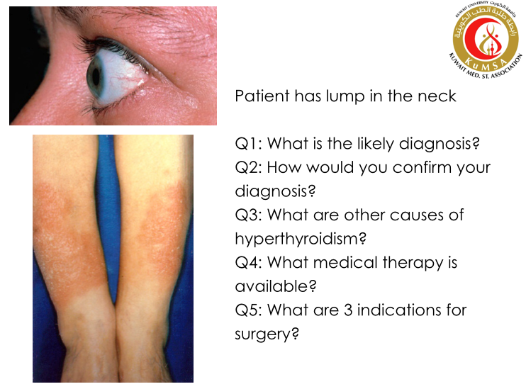 KuMSA_QnA's tweet photo. #medicine #eloops https://t.co/wdb473JroD