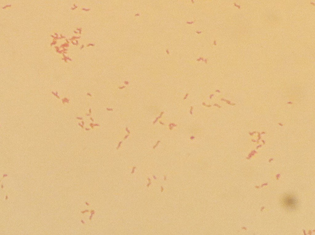 Campylobacter Stool Culture - Stools Item