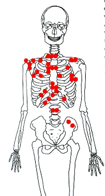 irarchaeology's tweet photo. A violent death in Early Medieval Meath https://t.co/v0OYTJ3DPM #archaeology #Meath #Ireland https://t.co/JoSLIcOkeX