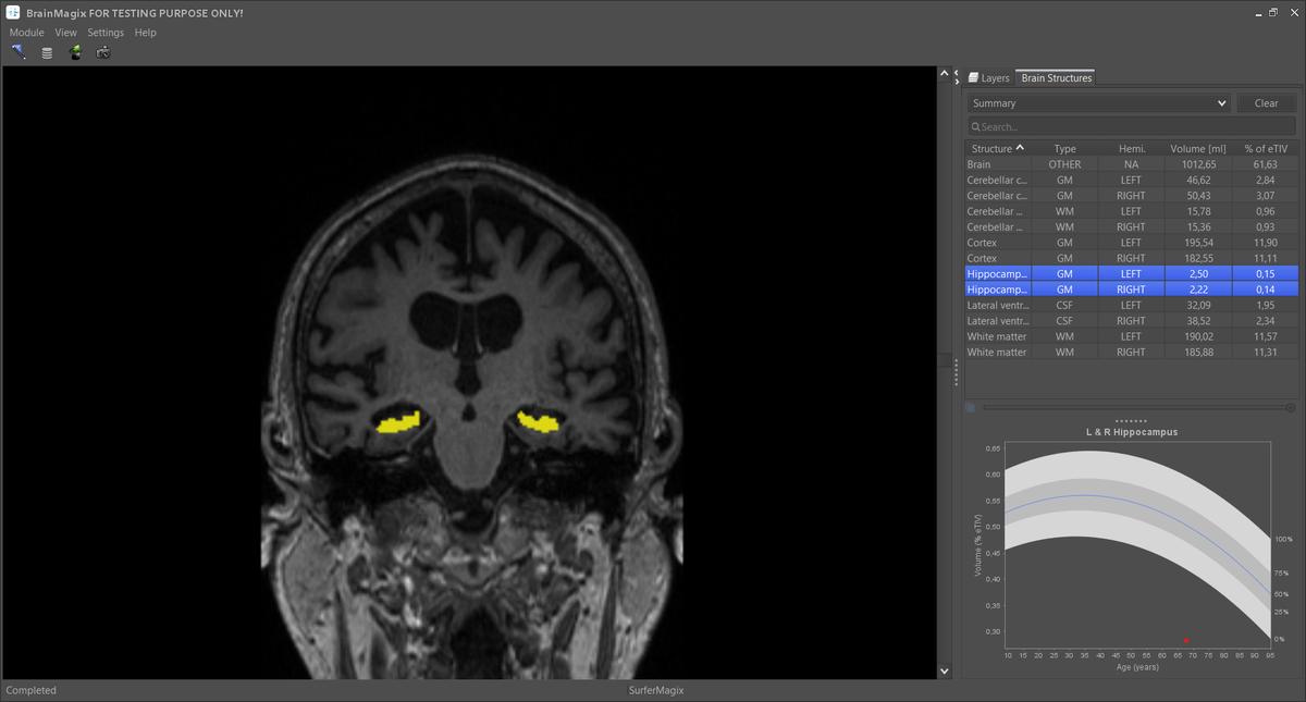 Imagilys's tweet photo. Imagilys Releases Version 2.0 of its Clinical #Neuroimaging Software Suite #BrainMagix https://t.co/1B9NbJkDzA https://t.co/tvEEyB0krZ