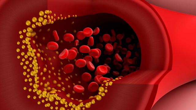 QuentinPIRET's tweet photo. Are lipid levels associated with abnormal tendon structure and tendon injuries ? https://t.co/eJtmLCm8gH https://t.co/HoIx7gcMJi
