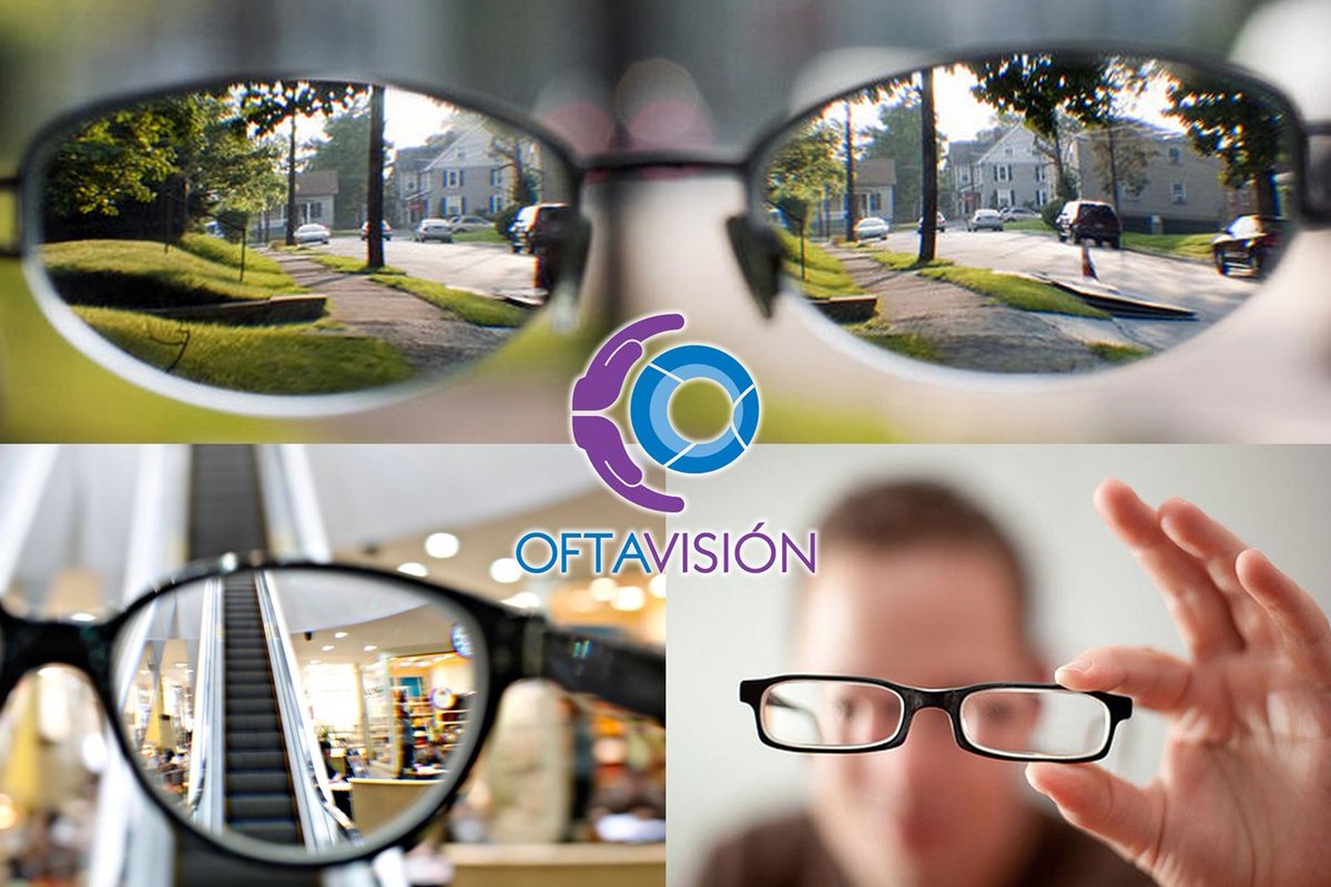 Miopía es un defecto de refracción del ojo donde el rayo de luz entra en un punto focal situado delante de la retina