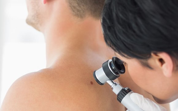 SmartsunSpain's tweet photo. Las diez enfermedades más comunes de la #piel #melanoma #cancer de #piel #protecciónsolar https://t.co/REvJSsiQLb https://t.co/zFe9HEeqiH