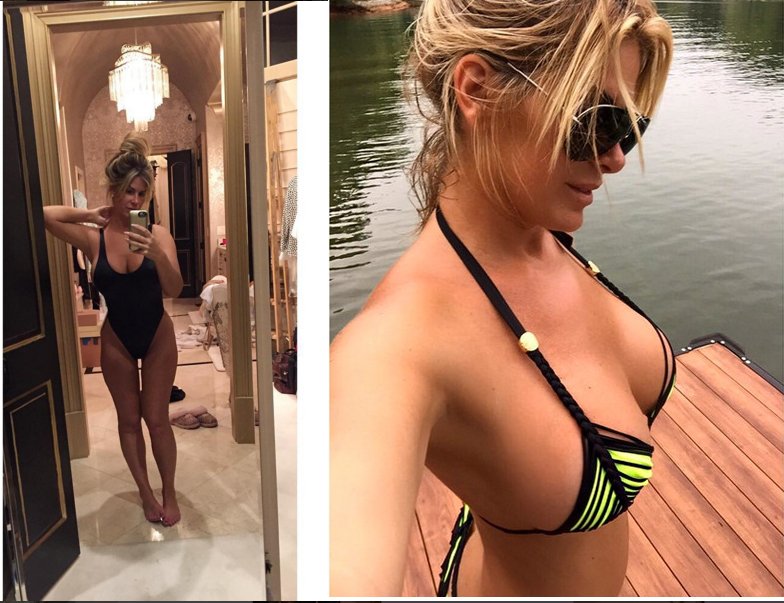 kim zolciak before and after tummy tuck