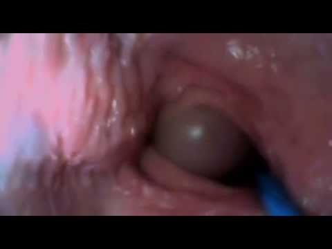 Inside Vagina Camera 118