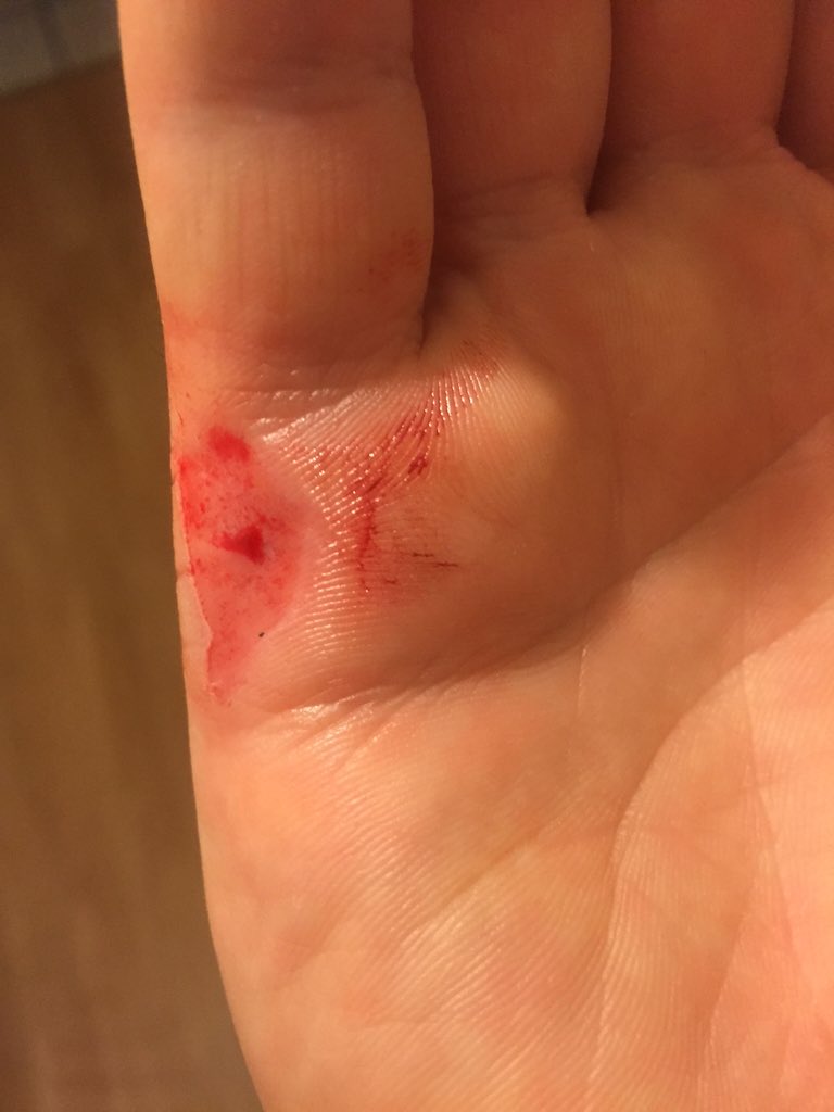 gregdog69's tweet photo. @powerleagueUK Need to smooth your boards off on pitch 2, Peterborough! Dangerous football at the moment. @sheltonjb https://t.co/7DURvxJAsq