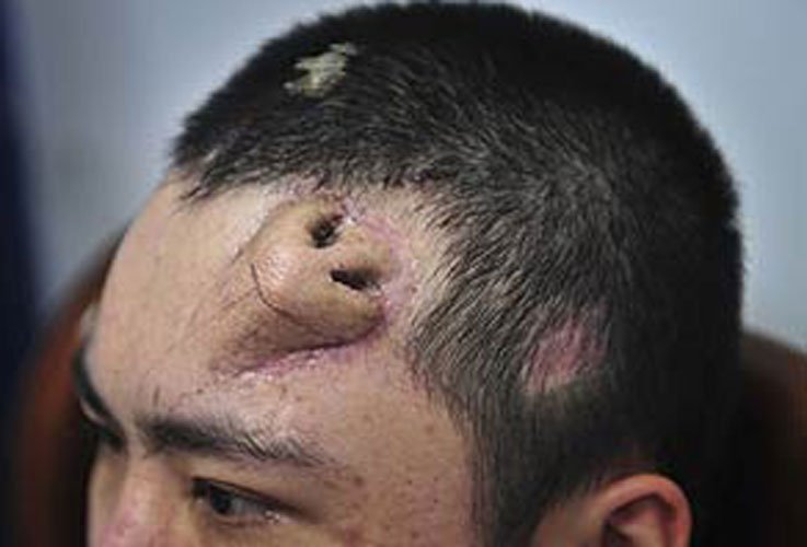 Patient with botched nose job kills doctor.  Can't blame the guy.   goo.gl/2aPUDb