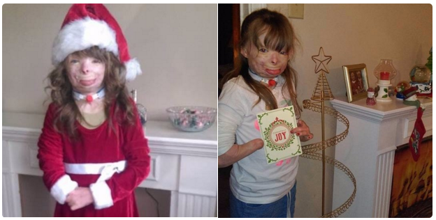 BuzzFeed's tweet photo. This girl whose entire family got killed in an act of arson just wants cards for Christmas https://t.co/RI4s5cBvfF https://t.co/dEhzoWkZVE