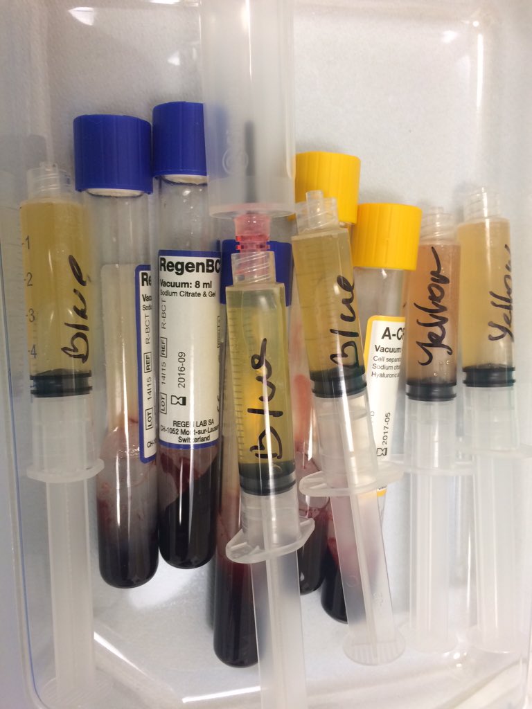 Patients from Saudi Arabia at #drbk having my latest techniques using plasma cellular matrix for rejuvenation