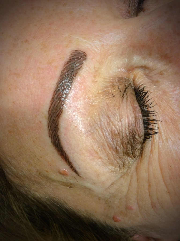 EmmaCleeve1's tweet photo. #combinationbrow #hairstrokebrows #hairimitation #realisticbrows #celebritybrows #3dbrowtattoo #tattoo #pmu https://t.co/CmwpZlMXeC