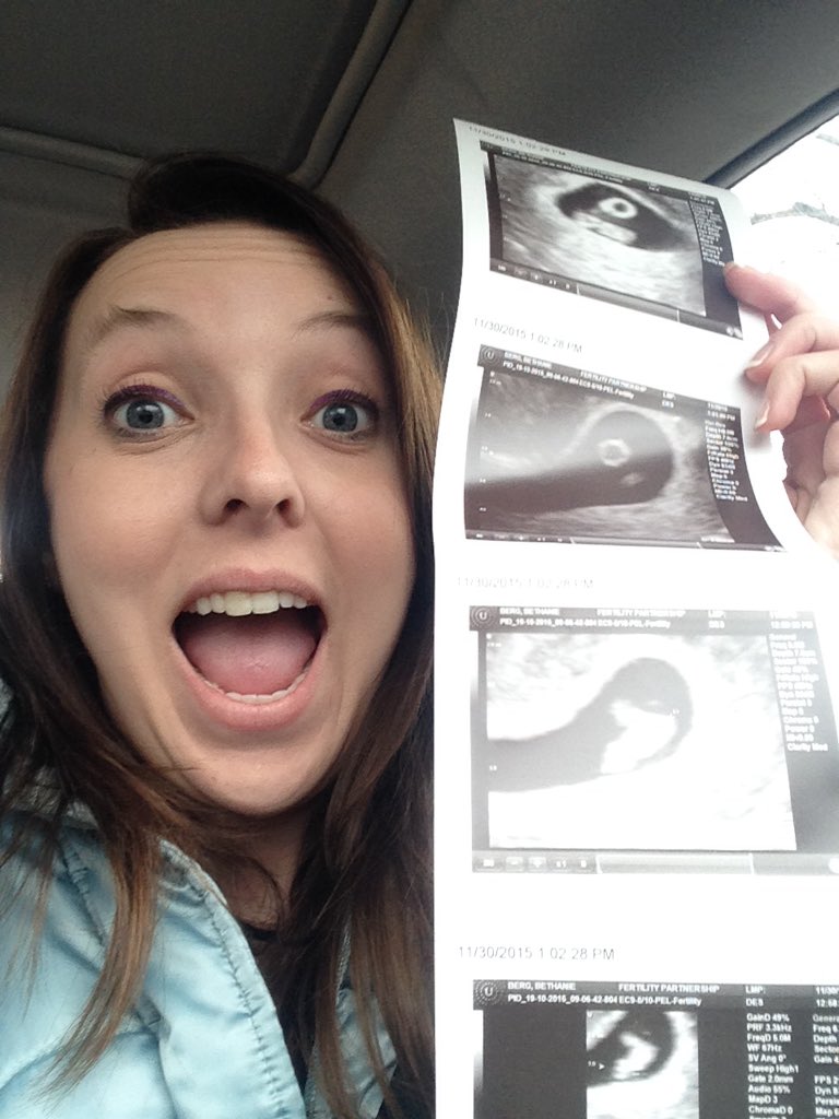 AwkwardInSTL's tweet photo. We have a HEARTBEAT! #heartbeat #pregnant #winning #IVF #fertilitypartnership https://t.co/5TEZJvSK0t