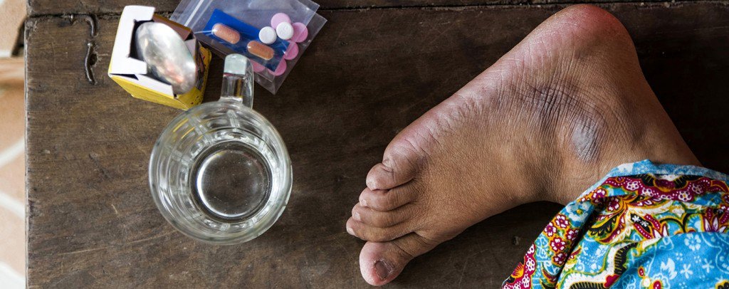 Stop Aids nel 2020, la lotta della Cambogia: la mia analisi su <a href="/pagina_99/">Pagina99</a> pagina99.it/2015/12/01/sto… #WorldAIDSDay