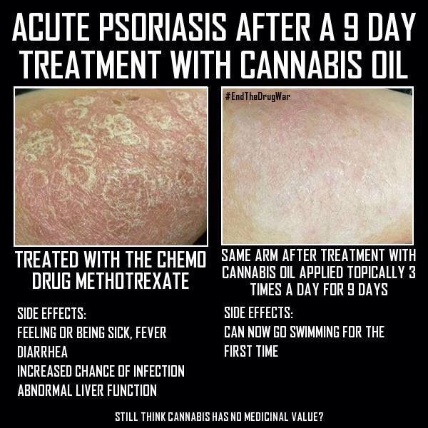 marijuanaDR's tweet photo. There are many instances when #cannabis proves to be the superior medicine to the pharma alternative. https://t.co/xfUv4SoMG2