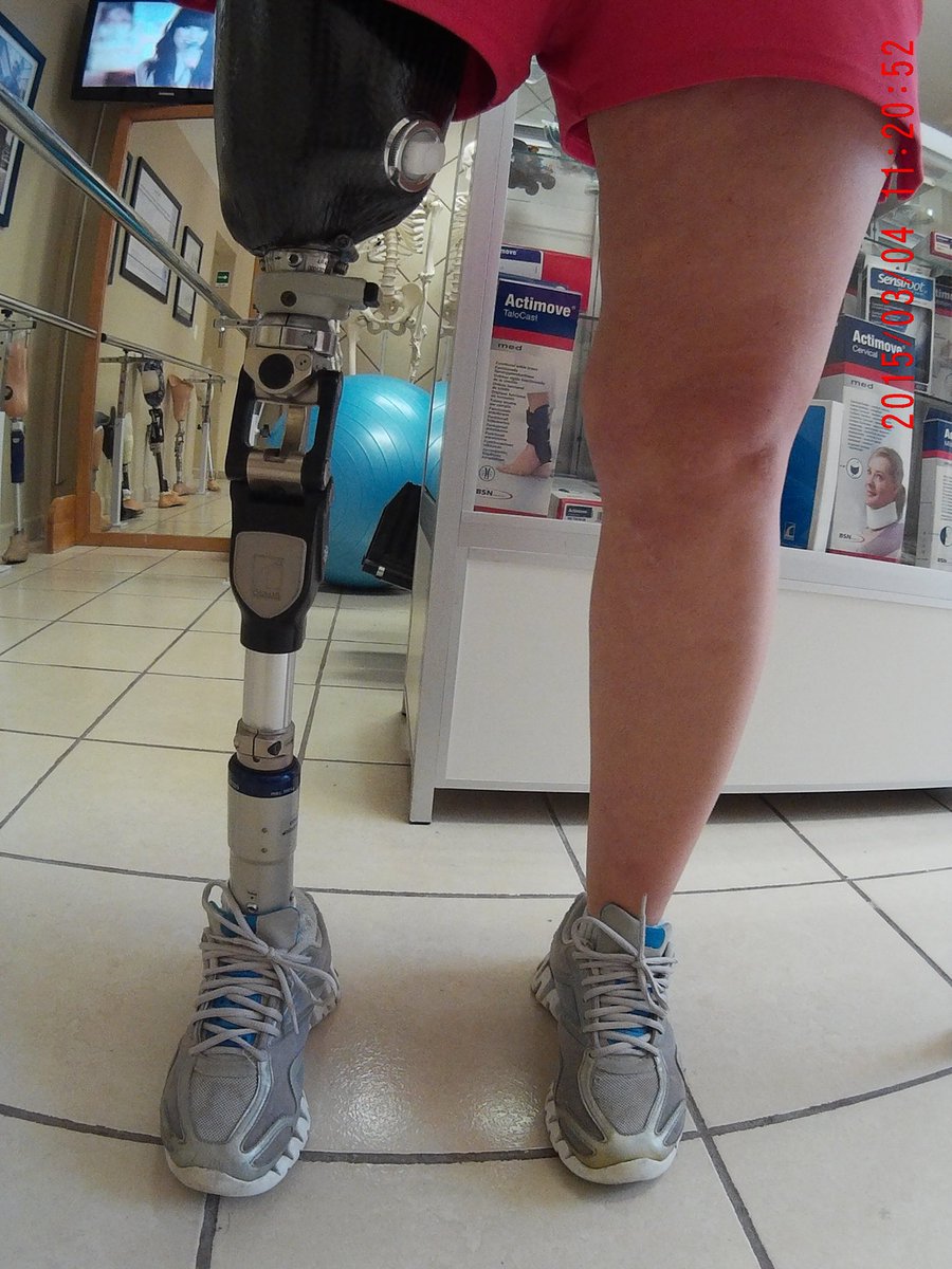 interbionic's tweet photo. #PrótesisDePierna de alta tecnología, siempre te recomendamos la mejor opción para tu rehabilitación. #Interbionic https://t.co/SoCKN1JgD0