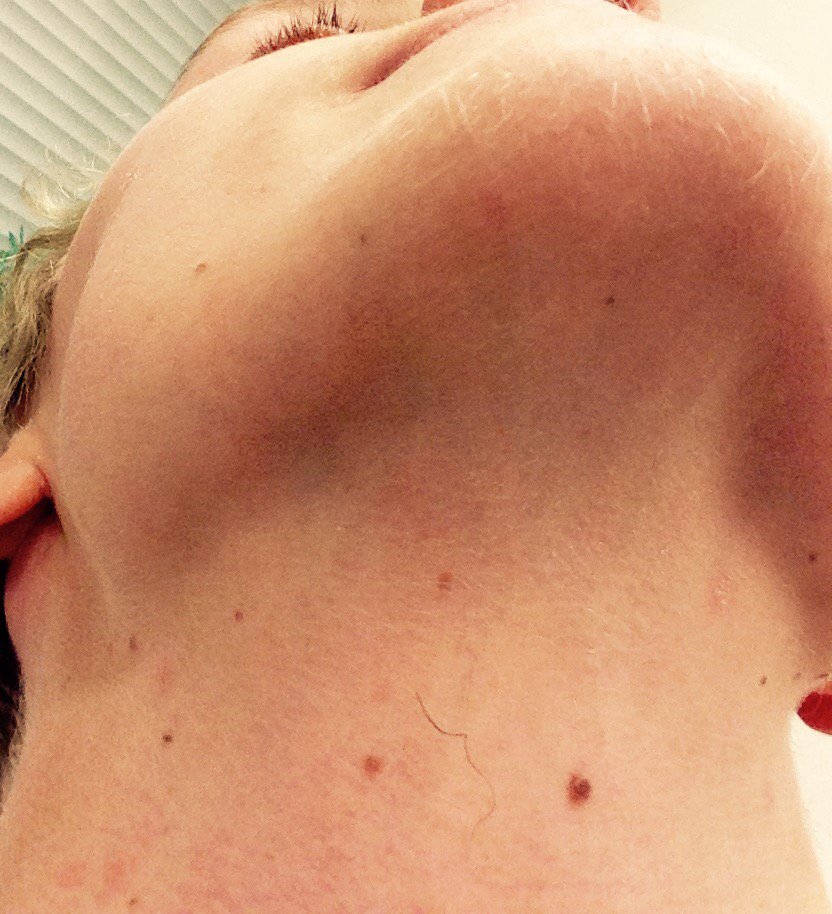 Hallandeer's tweet photo. Kvalité framför kvantitet @sebstax #noshave https://t.co/06UZphtUR8