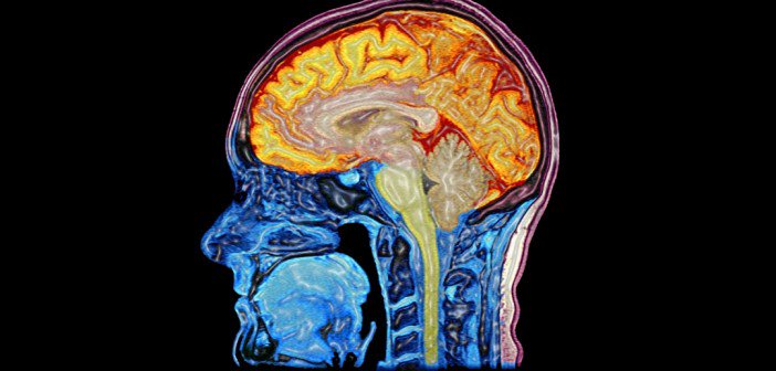 The brains of people with autism process facial expressions of emotion differently  psypost.org/2015/11/proces…