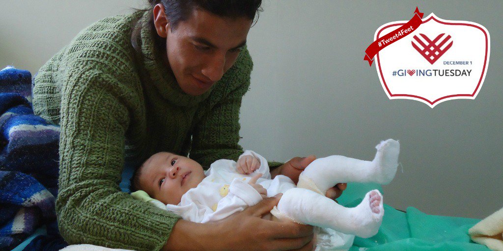 miraclefeet's tweet photo. Retweet and $1 will be donated to help treat #clubfoot around the world this #GivingTuesday. https://t.co/vfupYQMPRR
