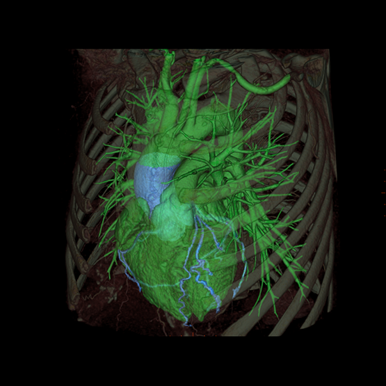 GEHealthCare's tweet photo. This year, we have at least 20 different ways to see the ❤ https://t.co/gNQGI1fhHK #RSNA15 https://t.co/MWYUvAFyYF