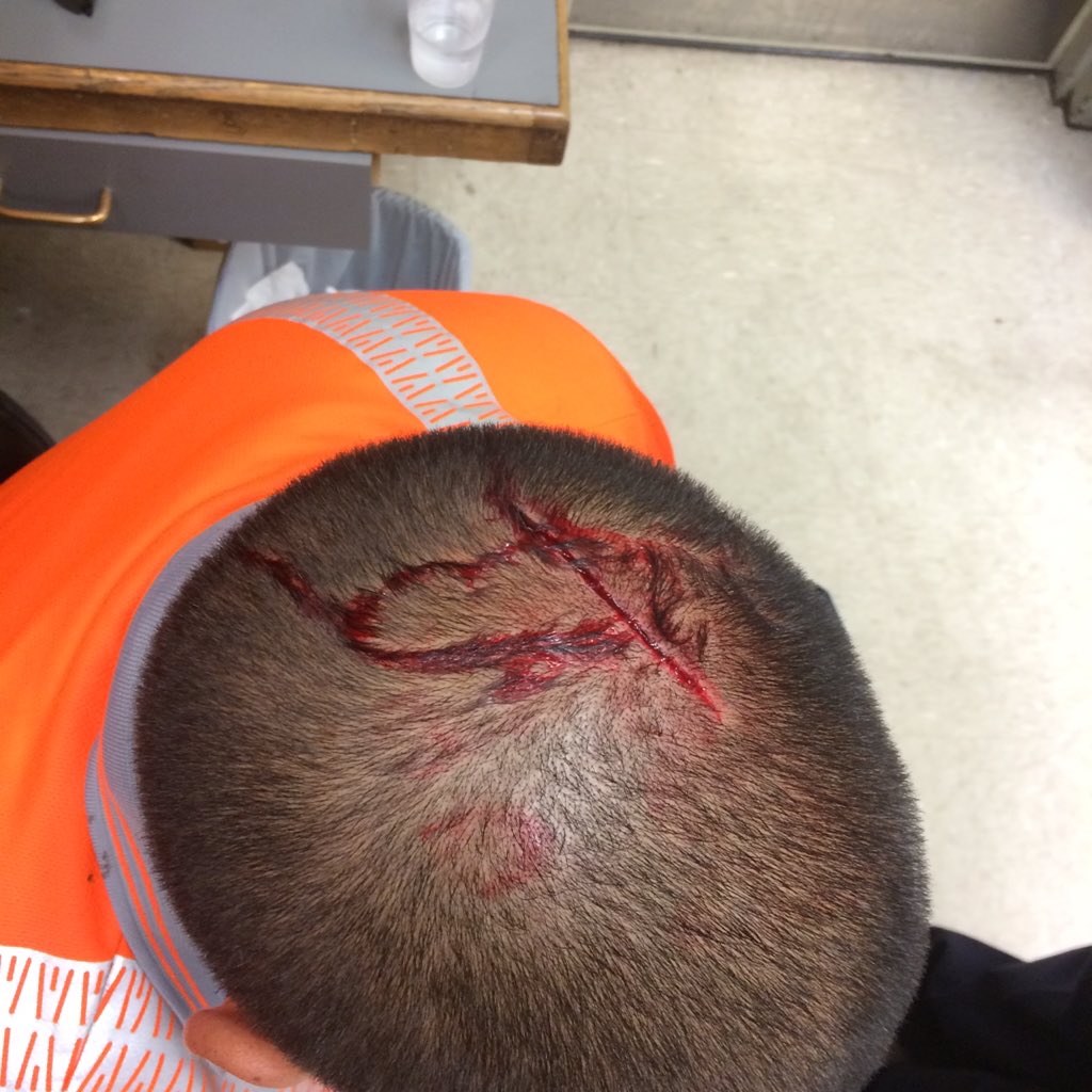 thaddddeus's tweet photo. Dr. Fronczak to the rescue. #GetTheGloves 🏥💉 https://t.co/ZIdUVR0gdq