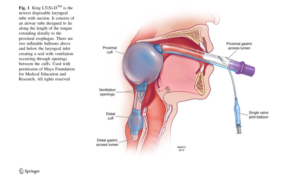 definitive airway definitive airway