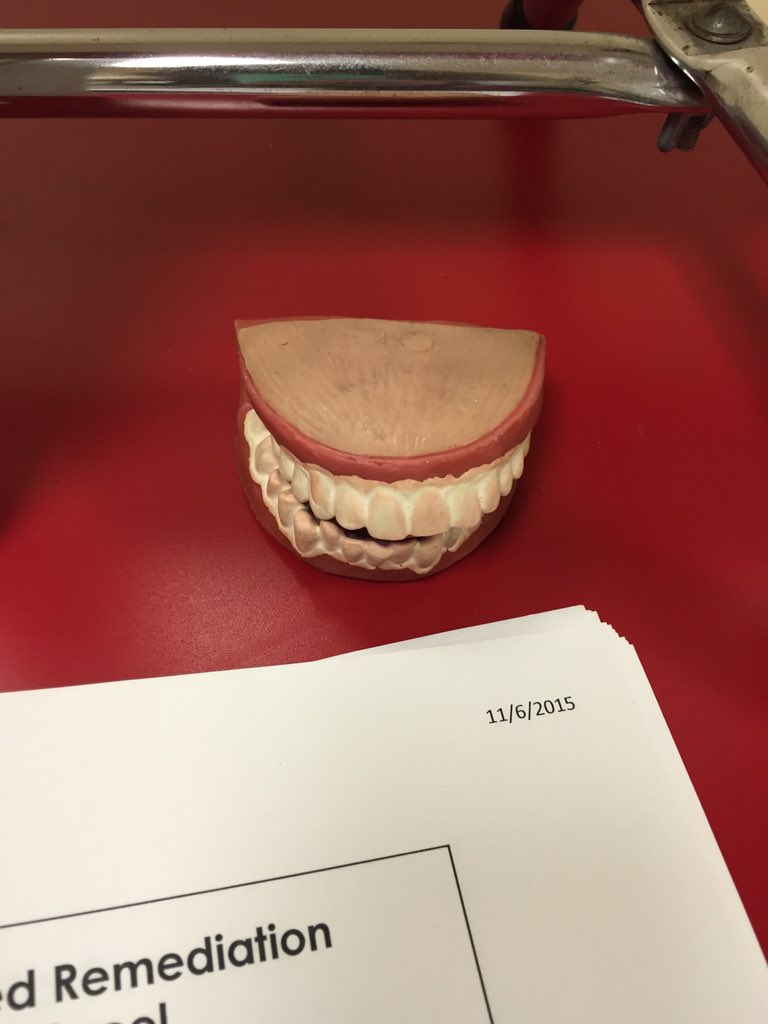malapontia's tweet photo. Mr. Mouth!Very cool way of teaching students how to say the r sound #essd40pd #essdexcels @LE_ESSD40 https://t.co/xCiLVnbR8g