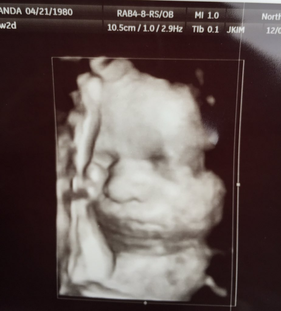 ajgilly3's tweet photo. 34 weeks and 2 days. Gotta love the right foot on his face! https://t.co/jvPloESdpz
