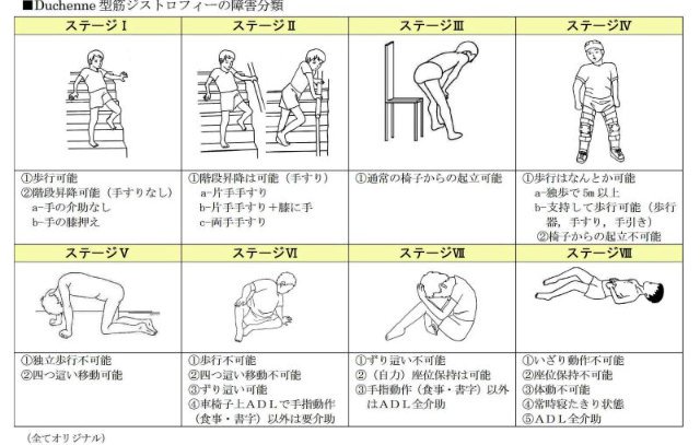 트위터의 加藤 慶紀 님 Pts4x2 ステージ毎の理学療法 2 下腿三頭筋のストレッチ 3 可動域訓練 ストレッチ以外に立位 歩行訓練 4 長下肢装具による歩行訓練 6 座位保持装置による脊柱変形の予防 7 8 非侵襲的陽圧換気療法の開始 筋萎縮 筋力低下が主な疾患