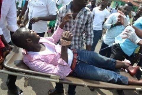 valbrownmc's tweet photo. BIAFRANS SHOT AND MURDERED AND FATALLY WOUNDED, BY DICTATOR BUHARI AND HIS BARBARIC, MURDEROUS SECURITY AGENTS @UNDP https://t.co/jkTjFa2B8W