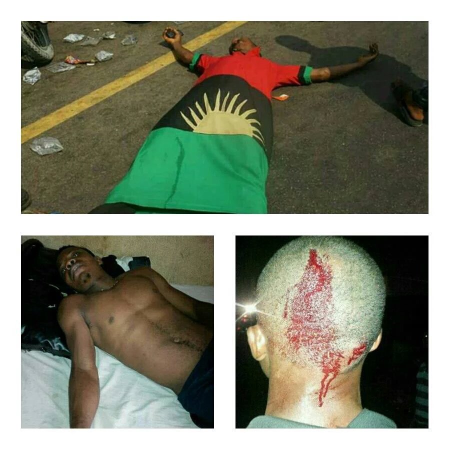 valbrownmc's tweet photo. BIAFRANS SHOT AND MURDERED AND FATALLY WOUNDED, BY DICTATOR BUHARI AND HIS BARBARIC, MURDEROUS SECURITY AGENTS @hrw https://t.co/myWHwILhbf