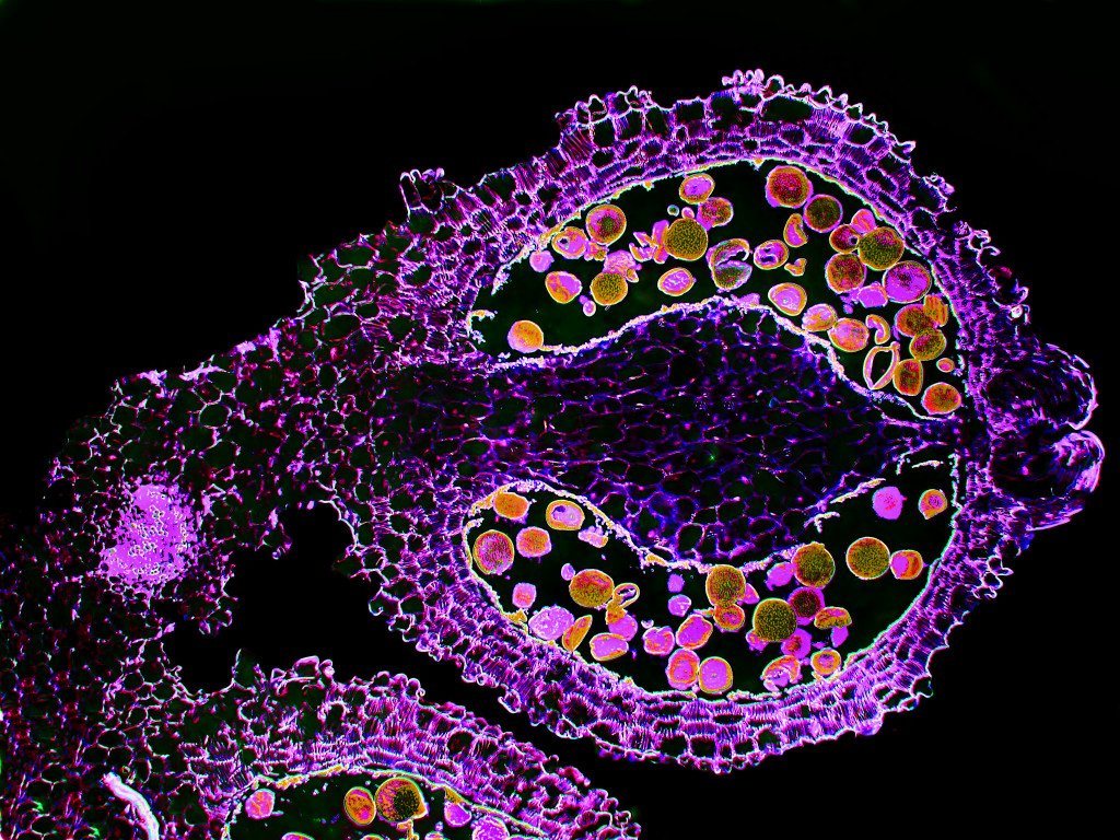 HaleITweet's tweet image. These #cell #micrographs give us a way better idea of what they actually look like bit.ly/1XGkmcv
