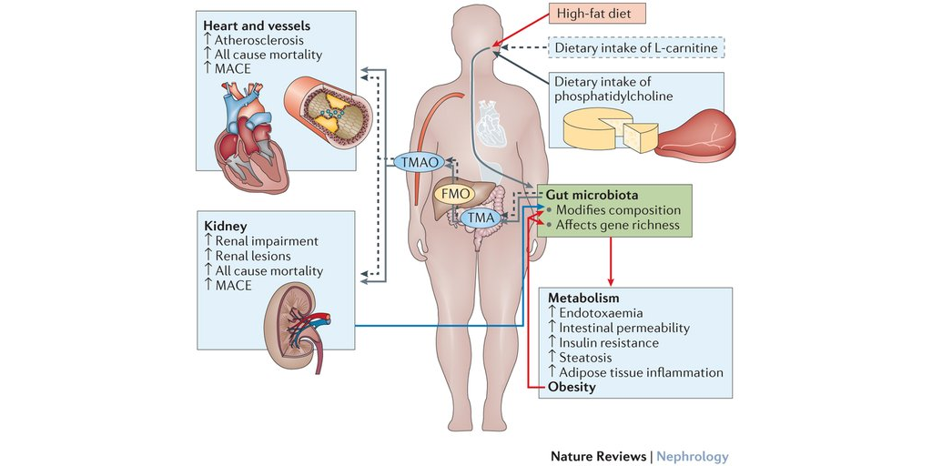 GutMicrobiotaWW's tweet photo. '#gutmicrobiota, #diet and links to cardiometabolic and chronic disorders', via @nature https://t.co/gXEFOSmsFp https://t.co/ySMpQOgYkR