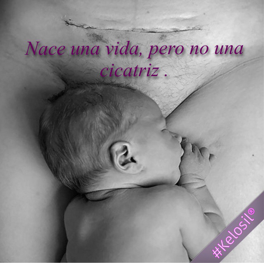 KelosilGold's tweet photo. #Kelosil por un mundo sin cicatrices. Porque un #Hijo es una bendición no una carga. https://t.co/8soxSExvUx