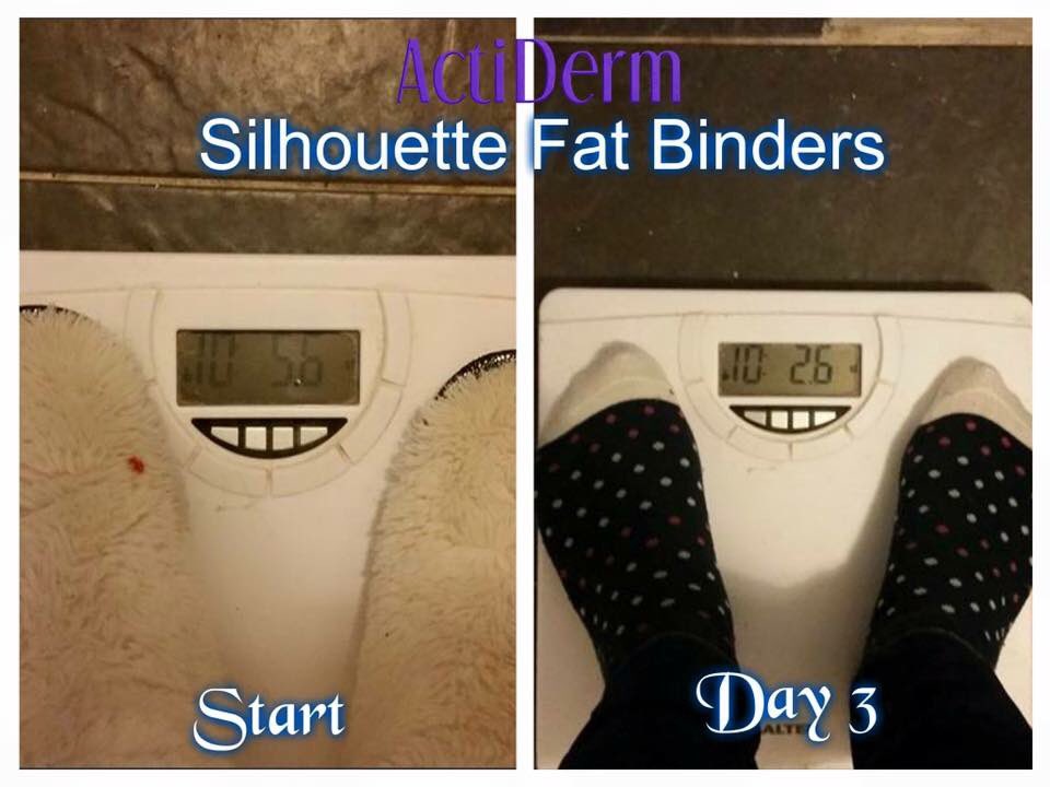 NicCleugh's tweet photo. Fab results coming from our ActiDerm Silhouette capsules. Anyone wanting to lose those extra pounds for Xmas? X https://t.co/i2UNQaQ4wG