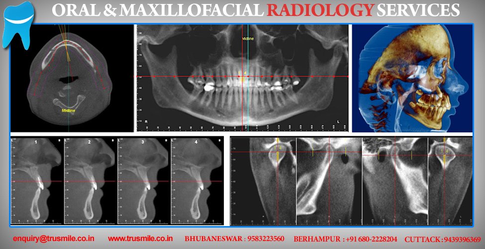 At #trusmilesbbsr #dentalcareclinic we provides all types of dental treatment including #Maxillofacialradiology.