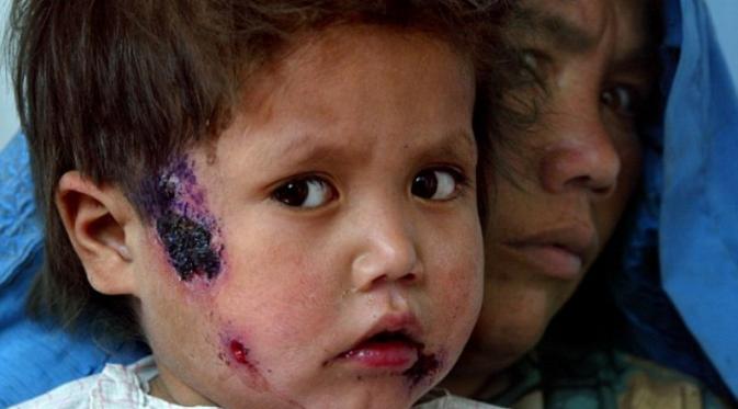 liputan6dotcom's tweet photo. ISIS Sebabkan 500 Penduduk Suriah Derita Leishmaniasis https://t.co/itR7V9odNc https://t.co/paoOPx0DhK