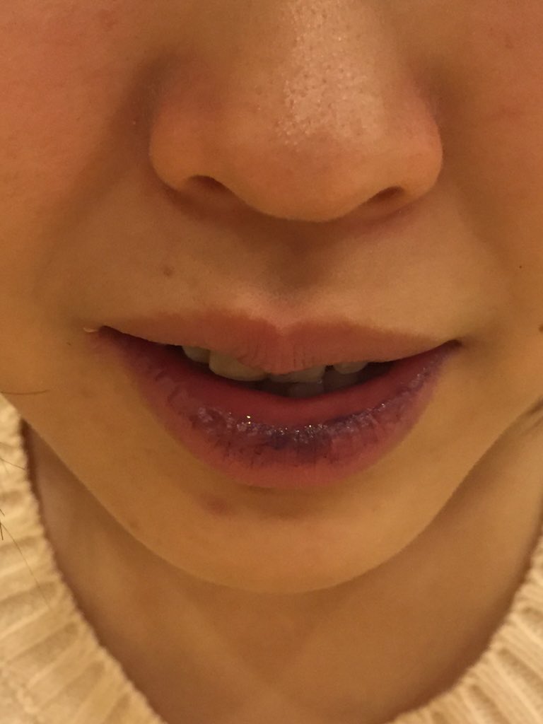 すみ え なんかうちら唇黒いンですけと E T Co Cbdvxz6or8