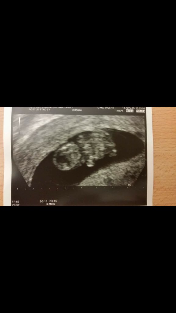 ChloeEliz96's tweet photo. GOING TO BE AN AUNTIE AGAIN!!!!!! https://t.co/zKuXVSQdso