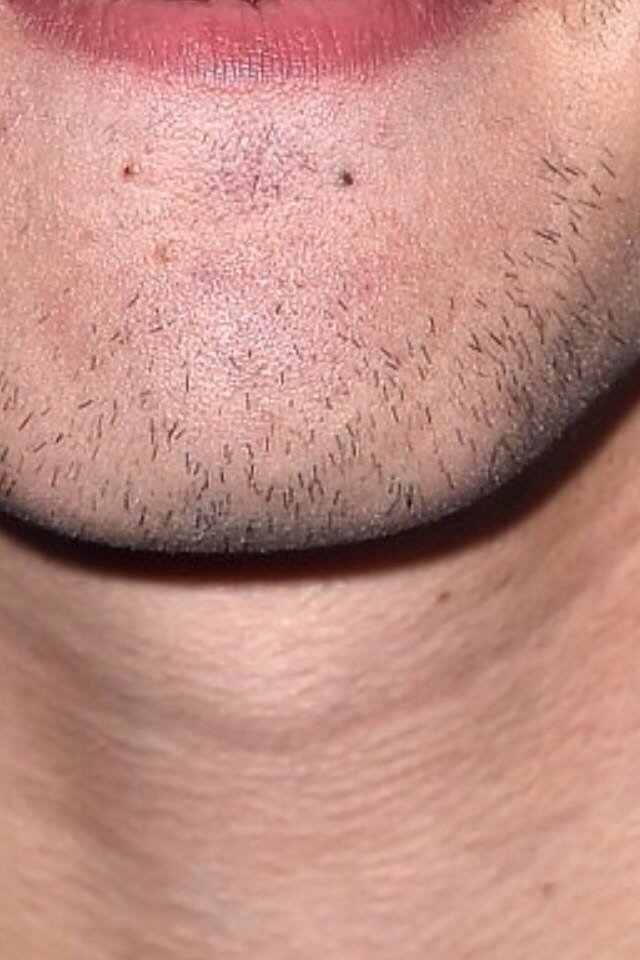 badbloodlrh98's tweet photo. but guys he has facial hair 😩😅

#MTVStars 5 Seconds Of Summer 

#VideoMTV2015 5 Seconds Of Summer https://t.co/swRWKv6c3v
