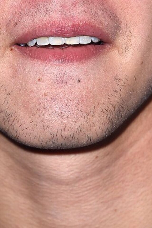 badbloodlrh98's tweet photo. but guys he has facial hair 😩😅

#MTVStars 5 Seconds Of Summer 

#VideoMTV2015 5 Seconds Of Summer https://t.co/swRWKv6c3v