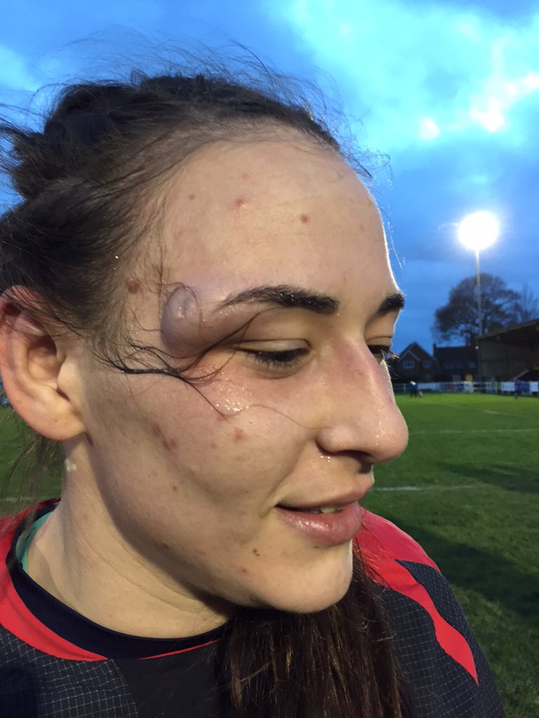 RugbyCanada's tweet photo. Demi Stamatakis is built tough #REDNATION https://t.co/iEhoO0wgza