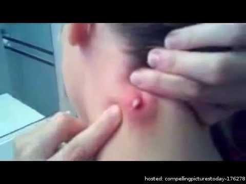 FightSide's tweet photo. His Girlfriend Felt Something VERY STRANGE... But When She Popped It... OMG! 😱😷🙊 https://t.co/w3B6fnuT5m https://t.co/iNzHbWDAUg