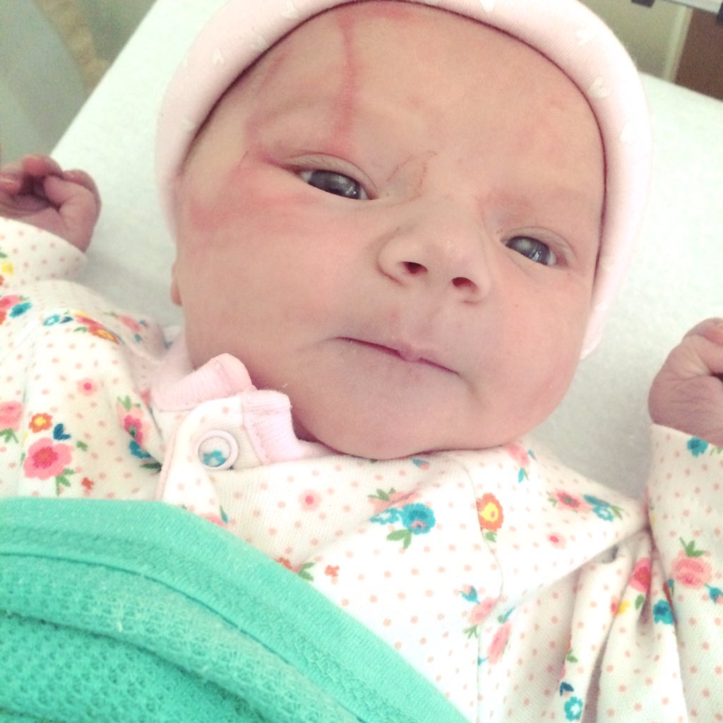 JustDispatch's tweet photo. My beautiful little girl was born yesterday morning at 3.58  so proud🙈❤️👧🏼👑 https://t.co/FsCA9ici1C