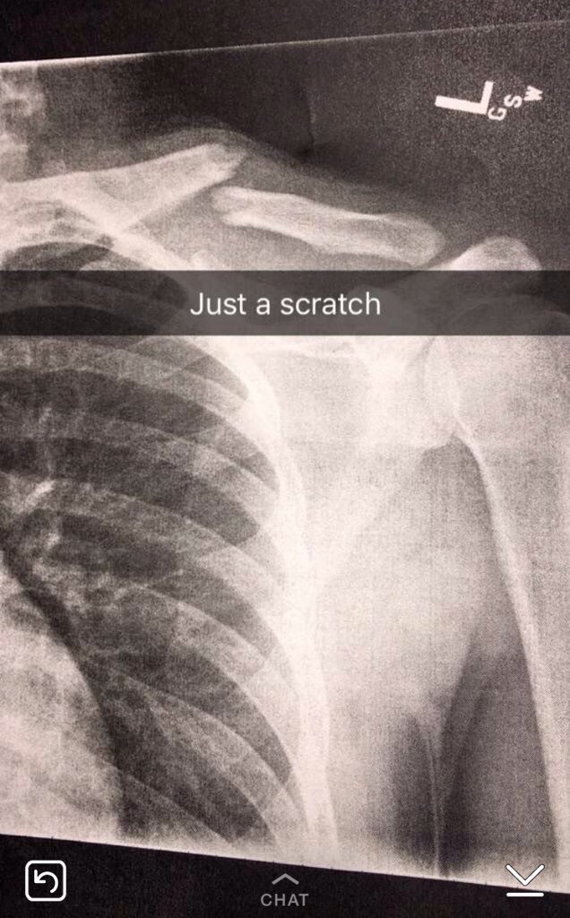 skatelifesrad's tweet photo. Skateboarders be like... https://t.co/RkNBWypNQA